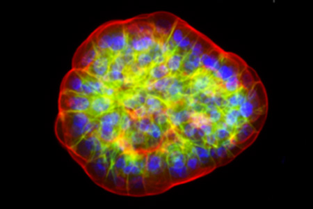 Tumor organoids