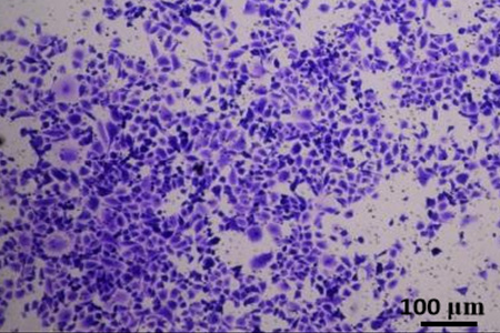Invasion Assays
