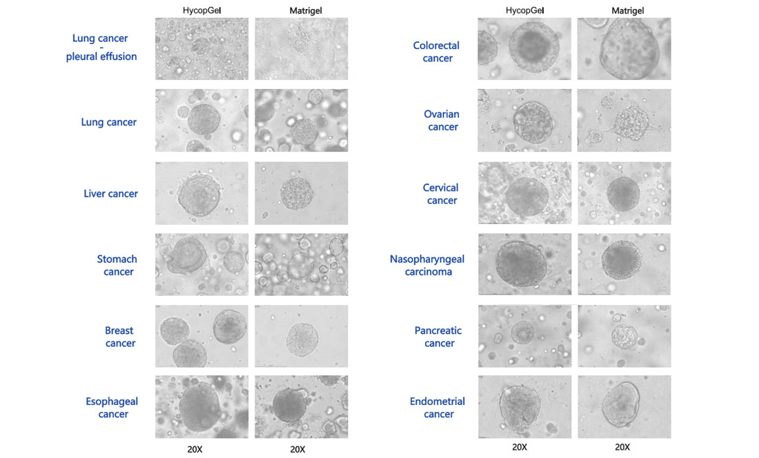 Multi-Cancer-Type Organoid Culture Cases